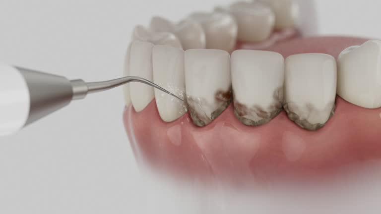 Reliable Tooth Extraction contractor in Beach, ND by Smile Center Dentistry